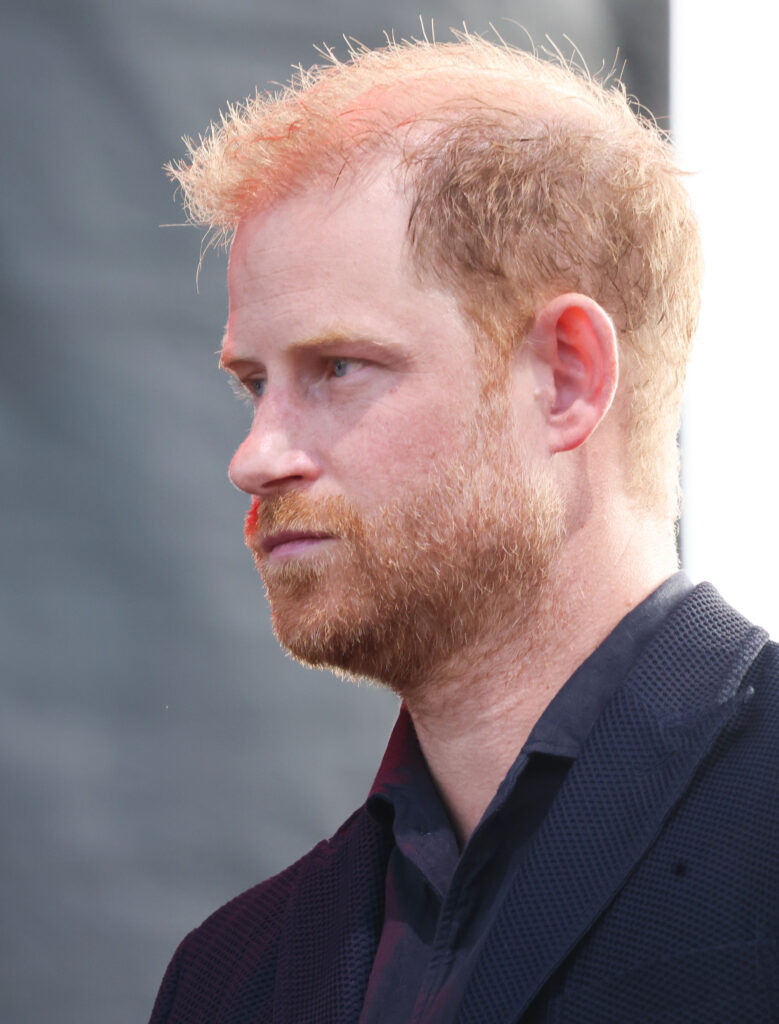 Prince Harry looking serious