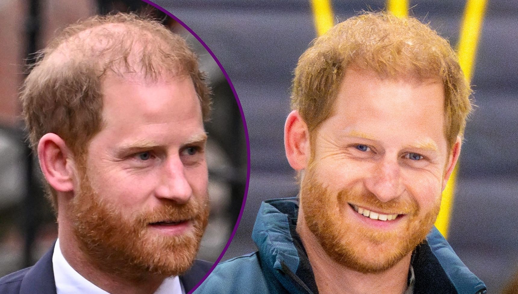 Prince Harry's joke about going bald as he admits 'I'm doomed'